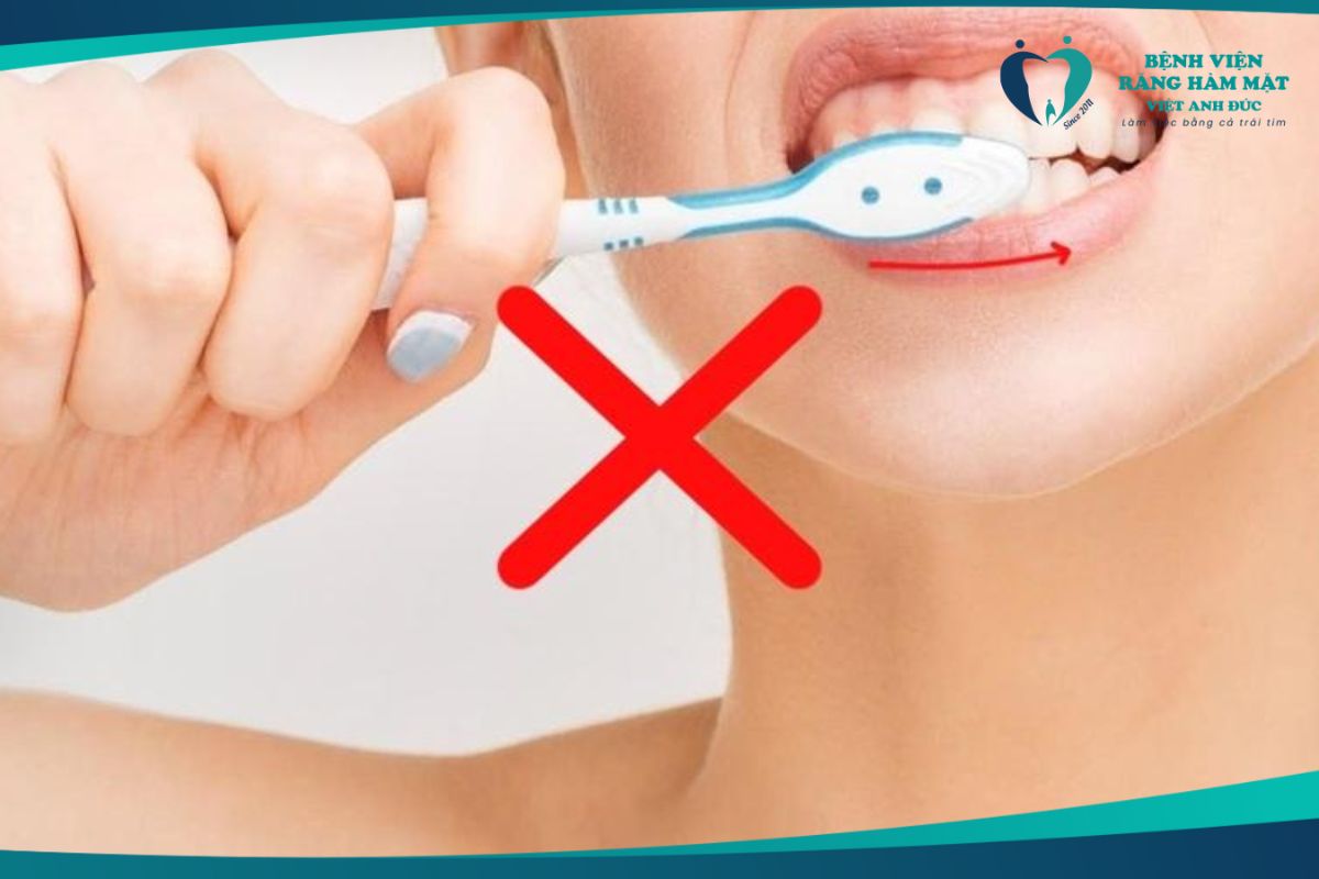 Đánh răng không đúng cách dẫn đến nhiễm màu răng

